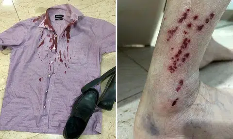 3 elderly folks injured after falling while on escalator at Clementi MRT station