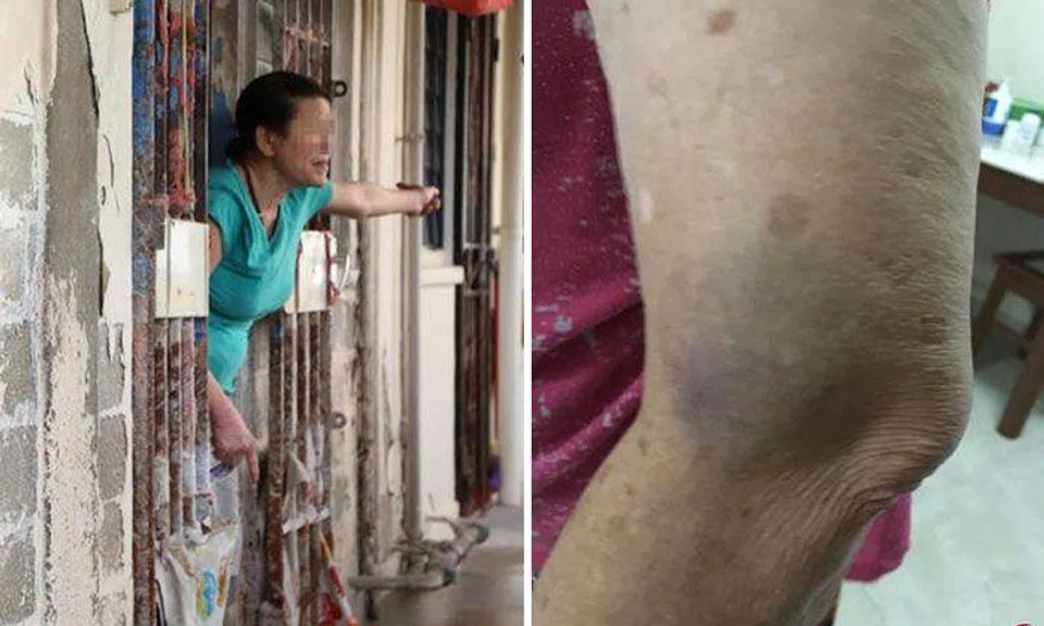 The elderly woman (left) allegedly swung a pail at her neighbour, injuring her left arm (right).