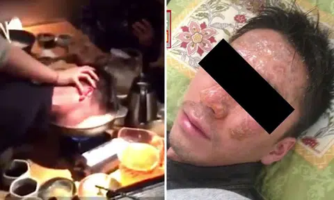 Japanese worker sues company president for shoving his face into boiling hotpot as a 'prank'