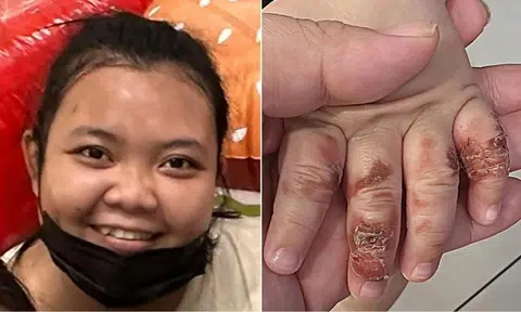 Nofitasari, 33, was sentenced to 22 weeks’ jail after pleading guilty to causing hurt to a 15-month-old boy under her care.