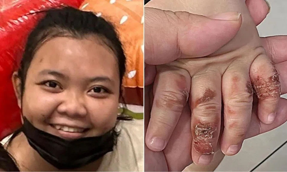 Nofitasari, 33, was sentenced to 22 weeks’ jail after pleading guilty to causing hurt to a 15-month-old boy under her care.