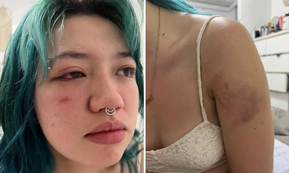 Ms Leeanne O'Donnell (pictured) said she was attacked after she tried to help defend Ms Julia Wong. PHOTOS: COURTESY OF MS LEEANNE O'DONNELL