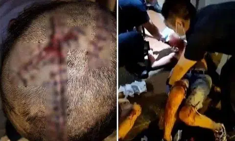 Mr Mohamad Amirul Shafi Abdullah slashed a man with a knife at Clarke Quay in March 2022 over a purported staring incident. PHOTOS: MS LOW