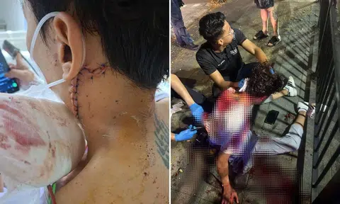 orchard road stabbing victim recounts attack