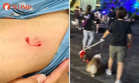 AVS looking into case of dog allegedly attacking Stomper's 4-year-old son at Christmas Wonderland