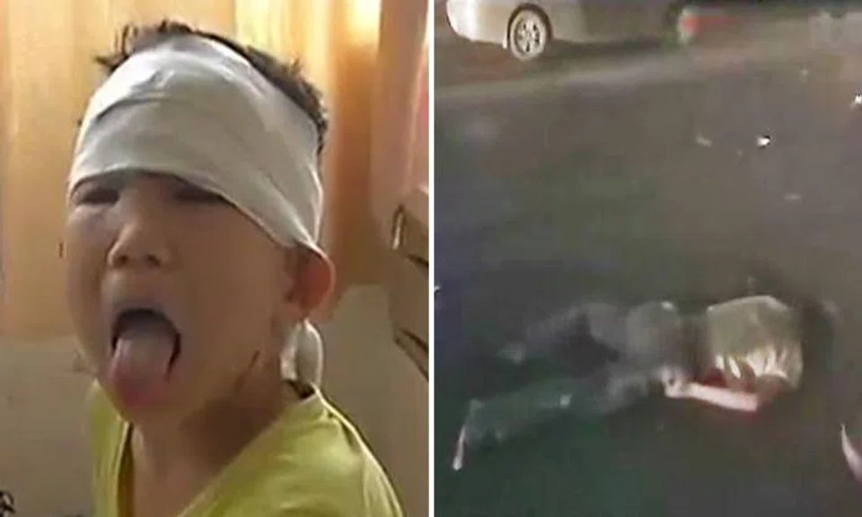6-year-old boy begs doctors to save dad first after scooter accident in China