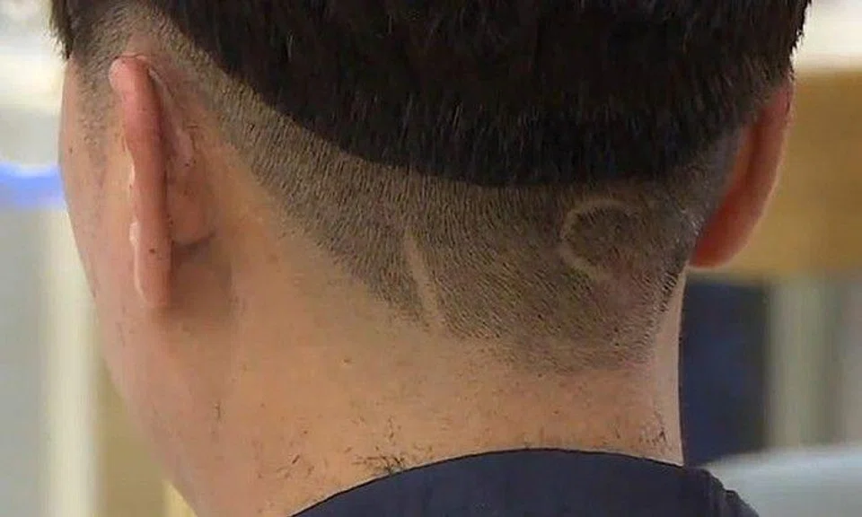 Look what happens when shaving initials on your hair goes terribly wrong