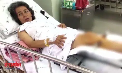 Thai masseur charges woman half price -- after breaking her leg during session 