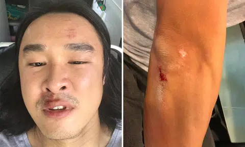 Julian Hee assaulted until he blacks out: Attacker hit actor's car while opening vehicle door