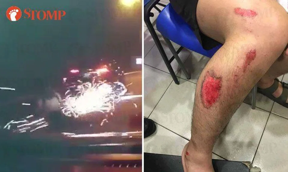 Motorcyclist injured after getting knocked off bike by car in hit-and-run accident on PIE