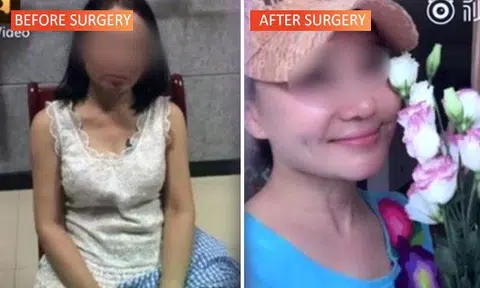 The 60-year-old woman underwent plastic surgery and "transformed" into a young lady in her 20s in order to evade her debtors. PHOTO: SHIN MIN DAILY NEWS