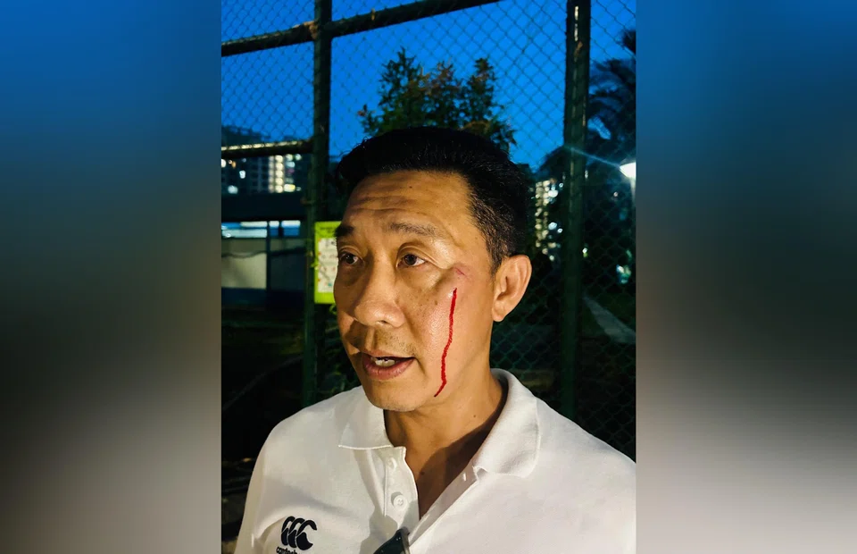 Mr Daniel Tay, parent of an Albirex Niigata youth footballer, sustained injuries to his left eye and cheekbone after the alleged assault on May 11.