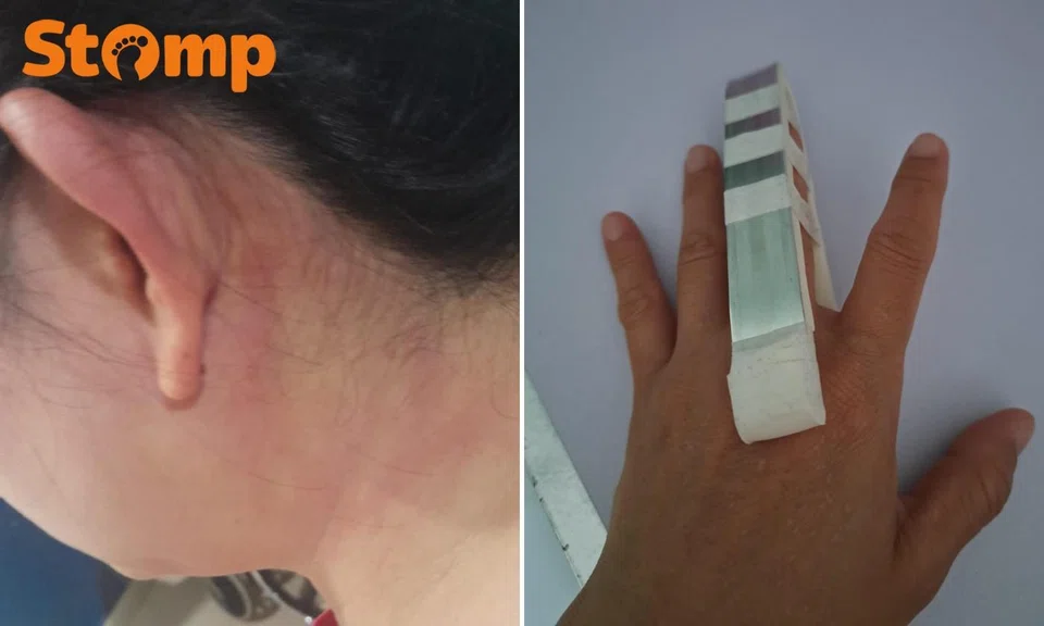 PHV driver suffered head injuries and a fractured finger after an altercation with a passenger.