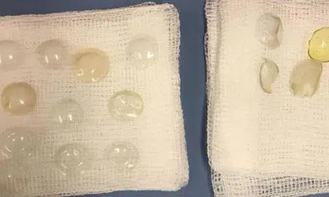 Photo: The Straits Times and World of Buzz