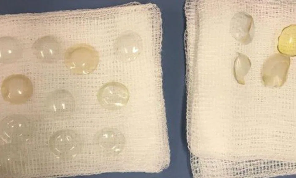 Photo: The Straits Times and World of Buzz