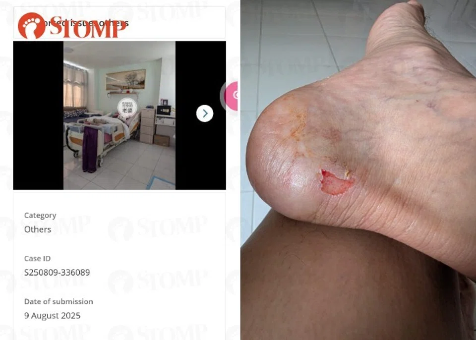 He reported the issue via the OneService app on Aug 9 to no avail. On Aug 15, he shared photos of his injured foot that resulted from the fall.
