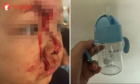 Toddler 'disfigured' after falling while using Evorie water bottle, father wants explanation