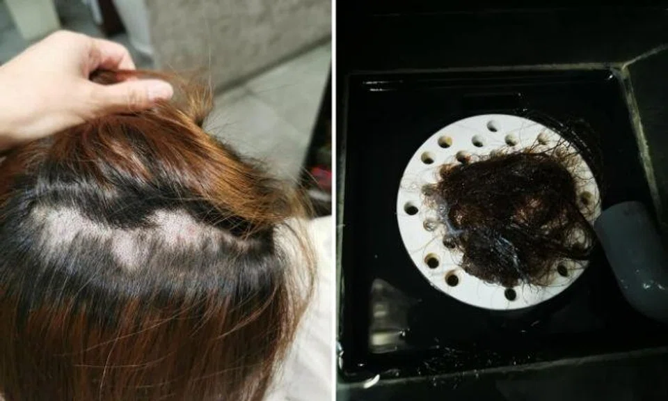 Woman ends up with 'big hole' on top of head after hair treatment at Jurong salon goes horribly wrong
