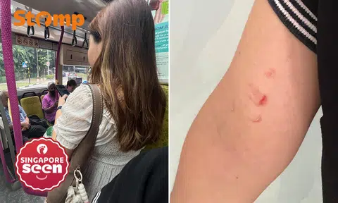 Bus passenger allegedly scratches mum with baby after repeatedly stepping on her feet