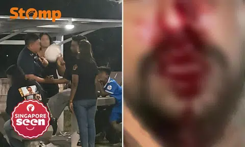 Group punch man over staring incident at Sembawang Beach Park