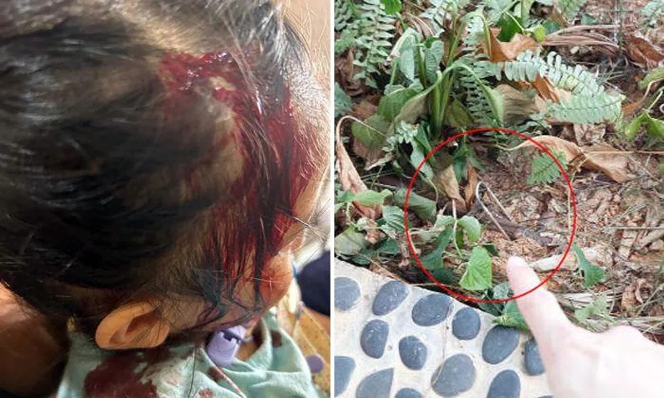 2-year-old girl bleeds from head after being hit by falling metal hook at Sengkang playground