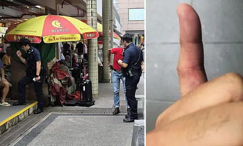 Man gets finger burnt by cigarette arguing with smoker at People's Park Food Centre, calls police
