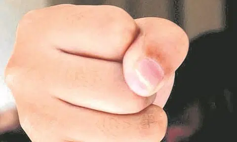 Prisoner ruptures and loses eye after fellow inmate rained blows on him