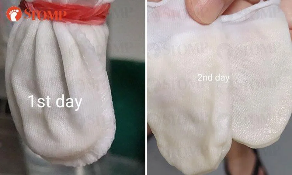 Are your water cloth filters at home discoloured? Here's why