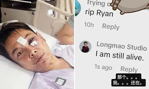 Actor Ryan Lian was slashed on the face in a recent knife attack that occurred outside Nex mall in Serangoon. PHOTOS: SHIN MIN DAILY NEWS, RYANLIANYY/INSTAGRAM