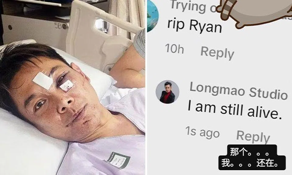 Actor Ryan Lian was slashed on the face in a recent knife attack that occurred outside Nex mall in Serangoon. PHOTOS: SHIN MIN DAILY NEWS, RYANLIANYY/INSTAGRAM