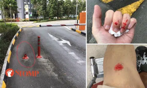 Man hurt after tripping over base of safety pole at Queenstown carpark exit: 'Clear case of negligence'