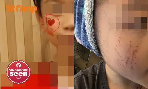 Child, 10, sustains scratches on face removing NDP tattoo, mother claims school did not call her