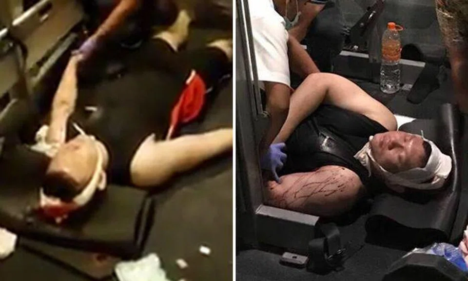 Weight falls on man's head after he loses grip while using smith machine at Surabaya gym