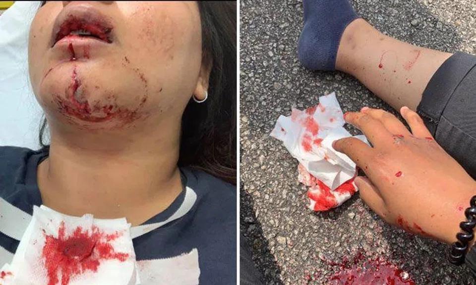 Female rider appealing for video footage after accident with car along CTE