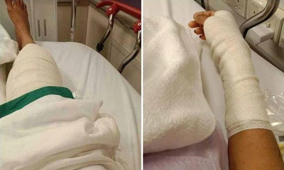 Animal lover suffers multiple wounds after wild boar attacks her 4 times along Bukit Panjang Road