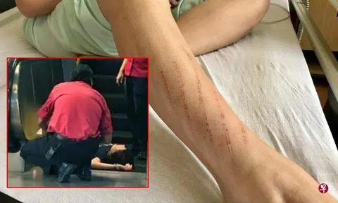 Female engineer who fell down escalator at Queenstown thanks kind souls who helped her