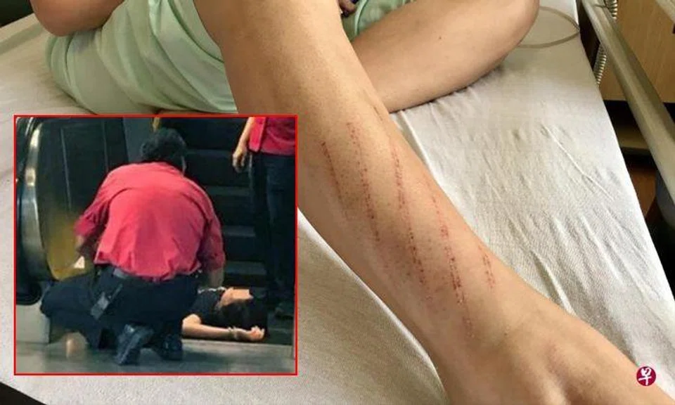 Female engineer who fell down escalator at Queenstown thanks kind souls who helped her