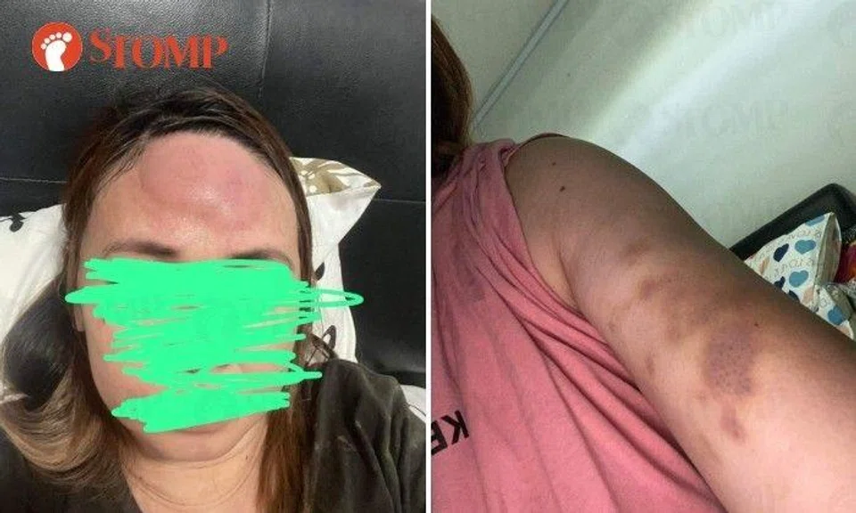  The employer held the maid by the back of her head and smashed her against the wall. He also punched her arm and legs.