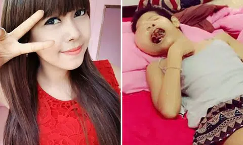 Thai woman disfigured by massive tumour on face dies at 28