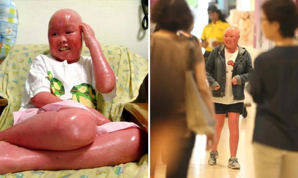 Photos: Lianhe Zaobao, TNP