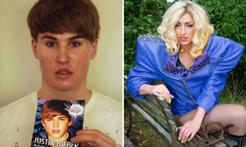 22 people tried plastic surgery to look like celebrities -- and most failed badly