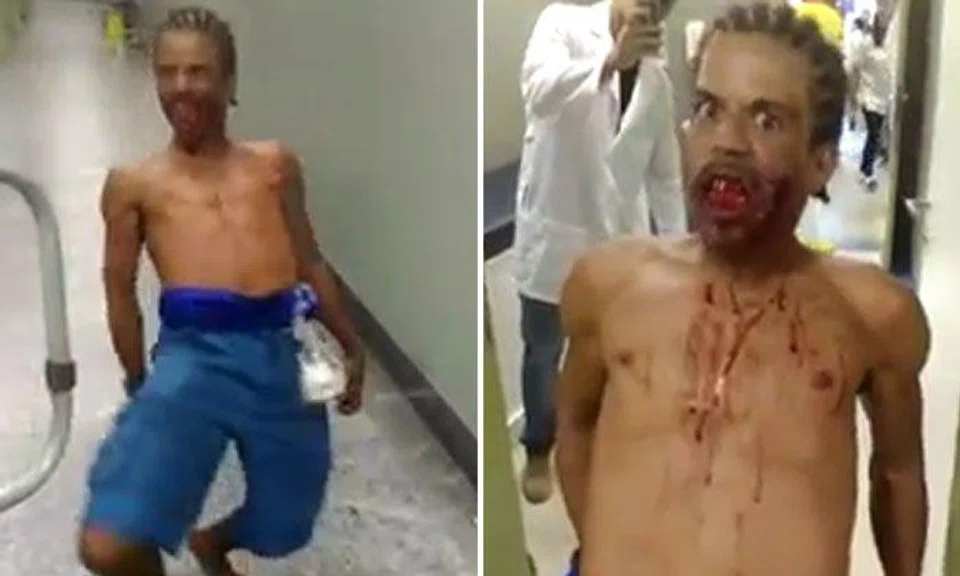 Blood-curdling footage shows Brazilian man acting 'possessed' after being shot in the face
