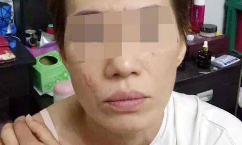S'pore woman allegedly punched in the face 10 times after trying to alight shared cab with couple in JB
