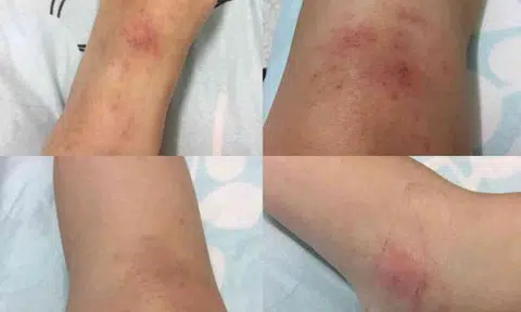 Malaysian woman gets shoved into foam and her chest groped during Siloso Beach countdown party: "I shouted but no one could hear me"