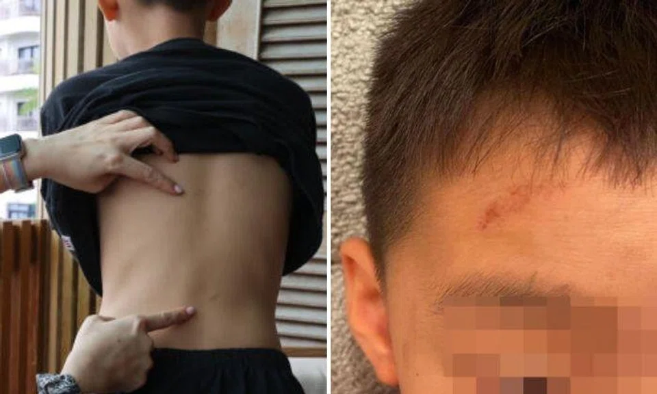 The boy's mother, referred to only as Ma, made a police report after the latest incident left her son with facial injuries. Photos: Shin Min Daily News