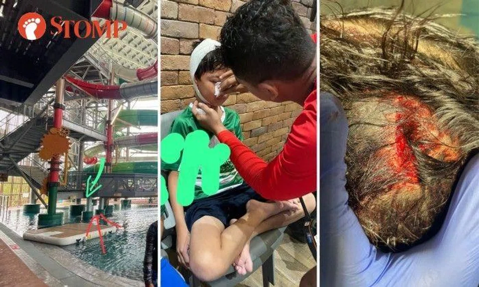 A nine-year-old boy was injured after hitting his head at Aqua Adventure, an indoor water park at HomeTeamNS Bedok Reservoir, on May 21.