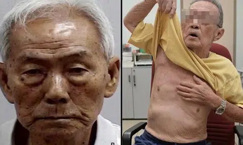 Photo: The Singapore Police Force, Lianhe Wanbao. The accused (left) the victim (right)