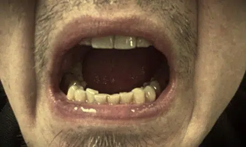 Photo illustration: Stomp