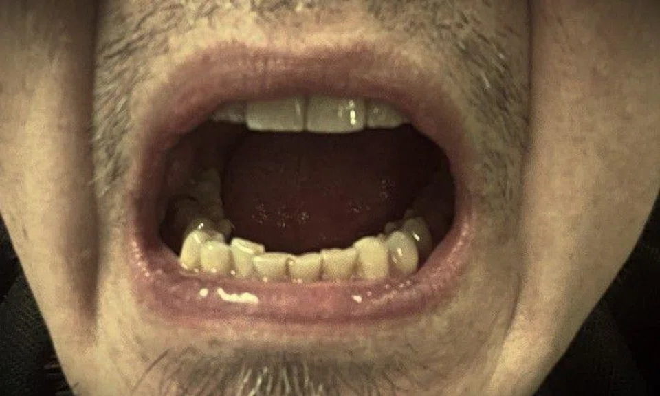 Photo illustration: Stomp