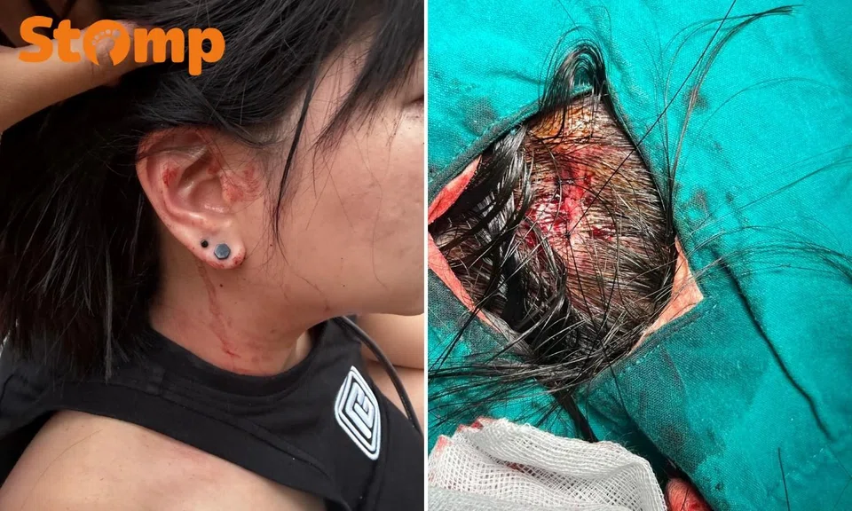 Stomper suffered a head injury in a fall during a trip to Bangkok